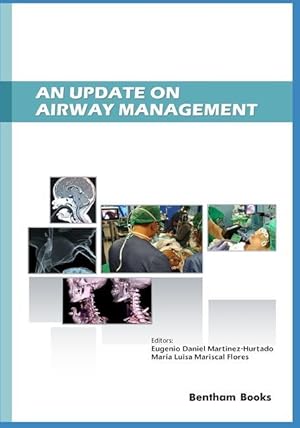 Bild des Verkufers fr An Update on Airway Management zum Verkauf von moluna