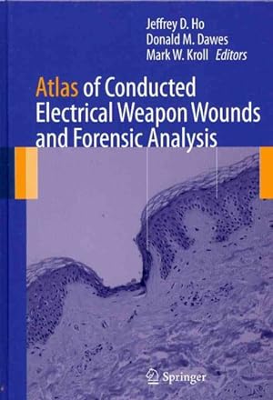 Bild des Verkufers fr Atlas of Conducted Electrical Weapon Wounds and Forensic Analysis zum Verkauf von GreatBookPricesUK