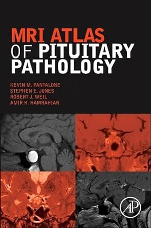 Bild des Verkufers fr MRI Atlas of Pituitary Pathology zum Verkauf von moluna