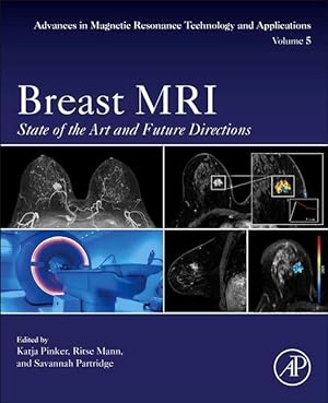 Bild des Verkufers fr Breast MRI: State of the Art and Future Directions zum Verkauf von moluna