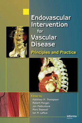 Seller image for Endovascular Intervention for Vascular Disease for sale by moluna