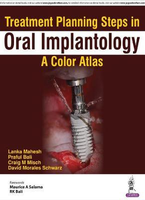 Seller image for Treatment Planning Steps in Oral Implantology for sale by moluna