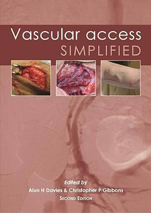 Bild des Verkufers fr Vascular Access Simplified zum Verkauf von moluna