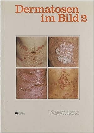 Seller image for Psoriasis for sale by Untje.com