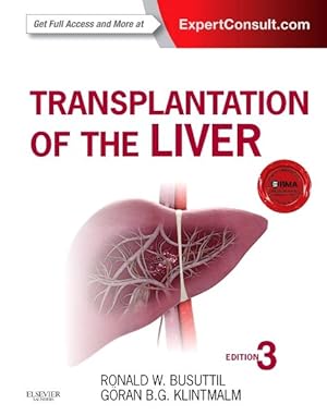 Seller image for Transplantation of the Liver for sale by GreatBookPricesUK