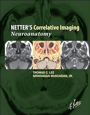 Seller image for Netter's Correlative Imaging : Neuroanatomy: With Netterreference.com Access for sale by GreatBookPricesUK