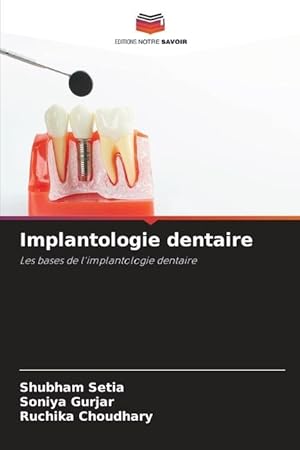 Bild des Verkufers fr Implantologa dental zum Verkauf von moluna