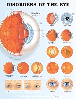 Immagine del venditore per Disorders of the Eye Anatomical Chart - Paper Unmounted (Wall) venduto da Grand Eagle Retail