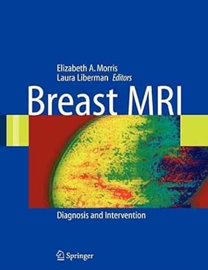 Seller image for Breast MRI : Diagnosis And Intervention for sale by GreatBookPrices