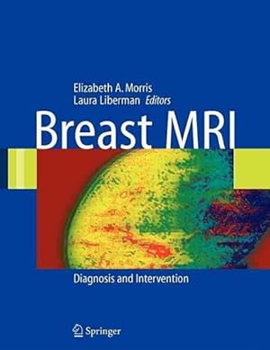 Seller image for Breast MRI : Diagnosis And Intervention for sale by GreatBookPrices