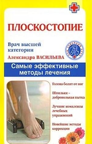 Seller image for Ploskostopie. Samye effektivnye metody lechenija for sale by Ruslania