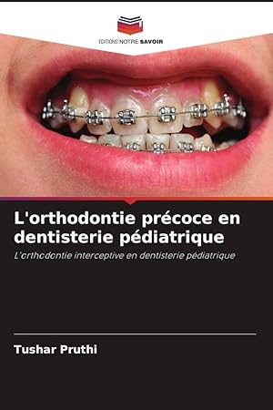 Bild des Verkufers fr L\ orthodontie prcoce en dentisterie pdiatrique zum Verkauf von moluna