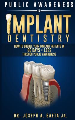 Seller image for Public Awareness In Implant Dentistry: How To Double Your Implant Patients In 60 Days Or Less Through Public Awareness (Paperback or Softback) for sale by BargainBookStores
