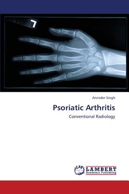 Immagine del venditore per Psoriatic Arthritis (Paperback or Softback) venduto da BargainBookStores