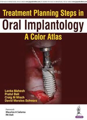 Seller image for Treatment Planning Steps in Oral Implantology : A Color Atlas for sale by AHA-BUCH GmbH
