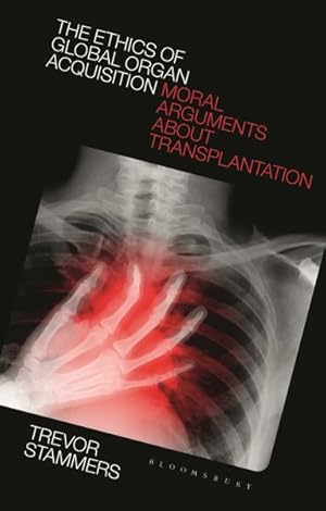 Seller image for Ethics of Global Organ Acquisition : Moral Arguments About Transplantation for sale by GreatBookPrices