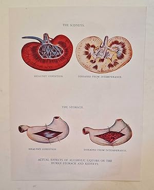 Effects of Alcohol on Stomach and Kidneys (Colour Print c.1926)