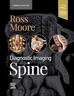 Bild des Verkufers fr Diagnostic Imaging : Spine zum Verkauf von GreatBookPrices