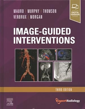 Seller image for Image-Guided Interventions for sale by GreatBookPrices