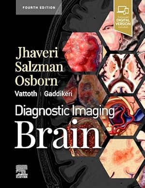 Seller image for Brain for sale by GreatBookPrices