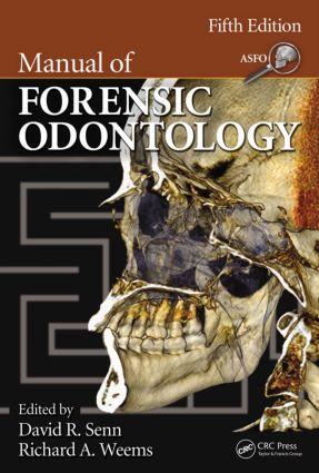 Seller image for Manual of Forensic Odontology for sale by moluna