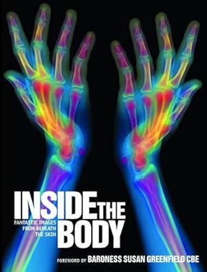 Bild des Verkufers fr Inside the Body: Fantastic Images from Beneath the Skin zum Verkauf von WeBuyBooks
