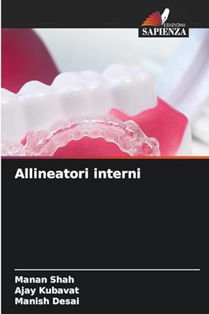 Seller image for Allineatori interni for sale by moluna