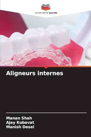 Seller image for Aligneurs internes for sale by moluna