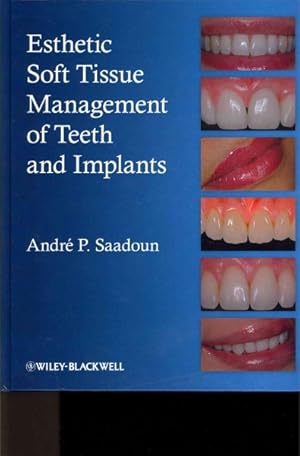 Imagen del vendedor de Esthetic Soft Tissue Management of Teeth and Implants a la venta por GreatBookPrices