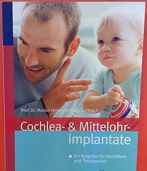 Image du vendeur pour Cochlea- & Mittelohrimplantate. Ein Ratgeber fr Betroffene und Therapeuten mis en vente par biblion2