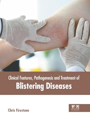 Image du vendeur pour Clinical Features, Pathogenesis and Treatment of Blistering Diseases mis en vente par GreatBookPricesUK