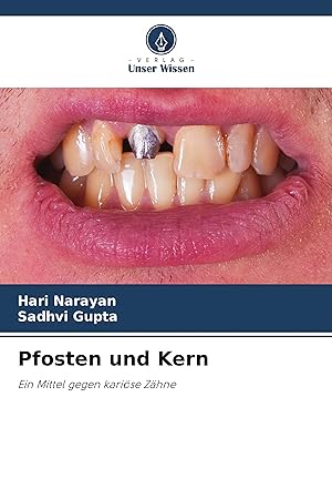 Immagine del venditore per Pfosten und Kern venduto da moluna