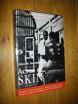 Bild des Verkufers fr Acres of Skin. Human Experiments at Holmesburg Prison zum Verkauf von Versandantiquariat Rainer Kocherscheidt