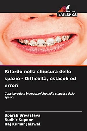 Bild des Verkufers fr Ritardo nella chiusura dello spazio - Difficolt, ostacoli ed errori zum Verkauf von moluna