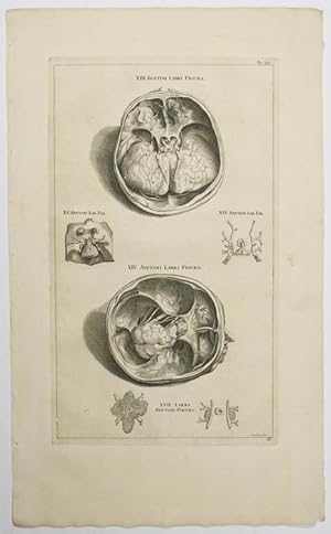 Opera omnia anatomica & chirurgica, 66. Tabula: Gehirn.