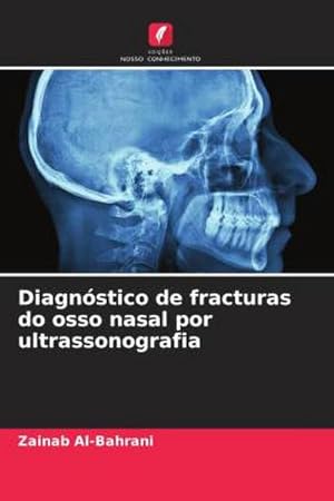 Seller image for Diagnstico de fracturas do osso nasal por ultrassonografia for sale by AHA-BUCH GmbH