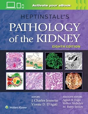 Immagine del venditore per Heptinstall's Pathology of the Kidney venduto da GreatBookPrices