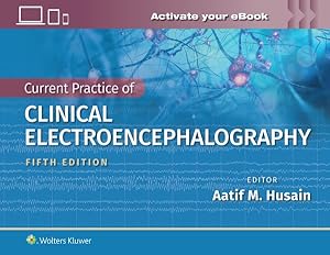 Bild des Verkufers fr Current Practice of Clinical Electroencephalography zum Verkauf von GreatBookPrices