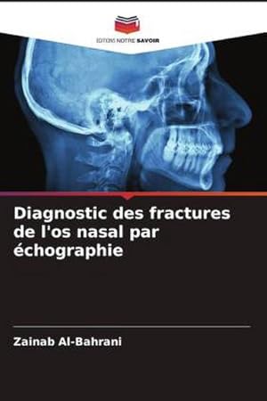 Image du vendeur pour Diagnostic des fractures de l'os nasal par chographie mis en vente par BuchWeltWeit Ludwig Meier e.K.