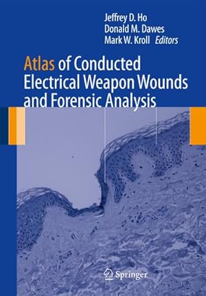 Bild des Verkufers fr Atlas of Conducted Electrical Weapon Wounds and Forensic Analysis zum Verkauf von BuchWeltWeit Ludwig Meier e.K.