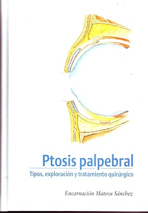Seller image for PTOSIS PALPEBRAL. TIPOS, EXPLORACION Y TRATAMIENTO QUIRURGICO. for sale by Librera Raimundo