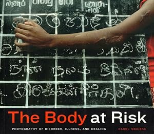 The Body at Risk: Photography of Disorder, Illness, and Healing