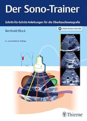 Bild des Verkufers fr Der Sono-Trainer : Schritt-fr-Schritt-Anleitungen fr die Oberbauchsonografie zum Verkauf von AHA-BUCH