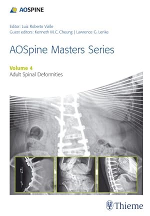 Seller image for Adult Spinal Deformities for sale by GreatBookPrices