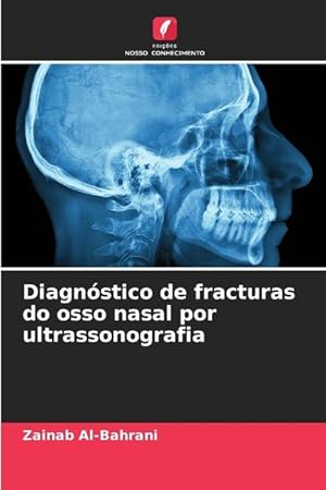 Seller image for Diagnstico de fracturas do osso nasal por ultrassonografia for sale by moluna