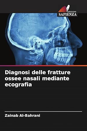 Seller image for Diagnosi delle fratture ossee nasali mediante ecografia for sale by moluna