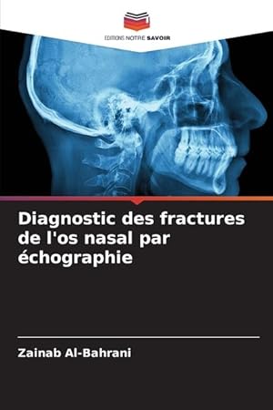 Seller image for Diagnostic des fractures de l os nasal par chographie for sale by moluna