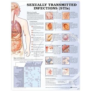 Seller image for Sexually Transmitted Infections Anatomical Chart for sale by Pieuler Store