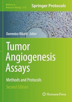 Bild des Verkufers fr Tumor Angiogenesis Assays : Methods and Protocols zum Verkauf von AHA-BUCH GmbH