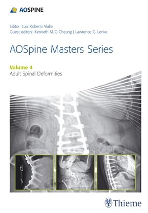 Seller image for Adult Spinal Deformities for sale by GreatBookPricesUK